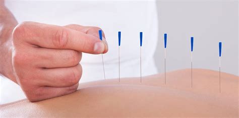 akupunktur ile kan basıncını düşürmek